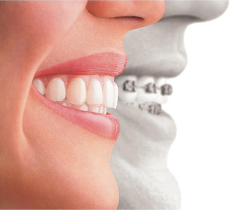 VegaDortaDental Dentista Barcelona Implantes dentales Urgencias Dentales Endodoncia Ortodoncia