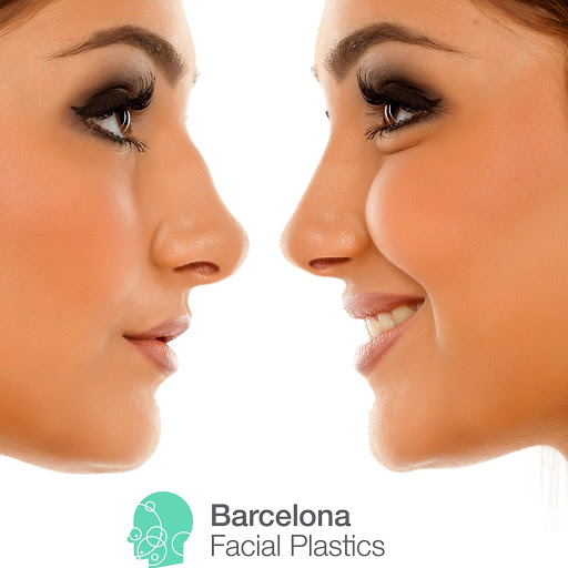 Barcelona Facial Plastics