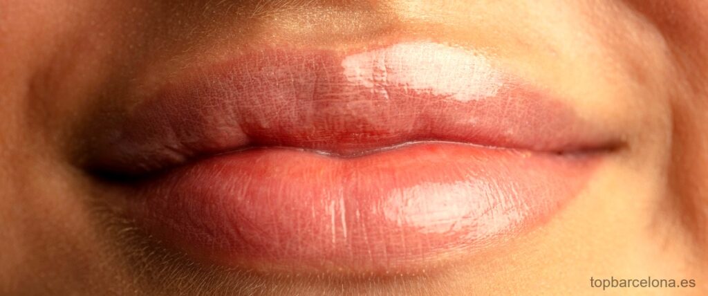 Las 20 mejores clínicas de Lip Lift en Barcelona